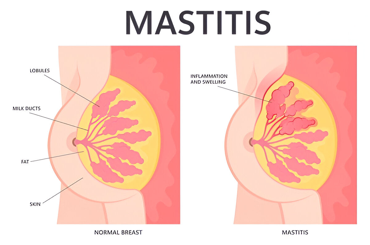 LactoBloom™ by Lixir Mart - Probiotic Gummy for Women’s Breast & Lactation Health
